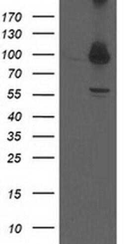 PSMD2 Monoclonal Antibody (OTI1D1), TrueMAB , OriGene 100 &mu;L; Unconjugated:Antibodies,