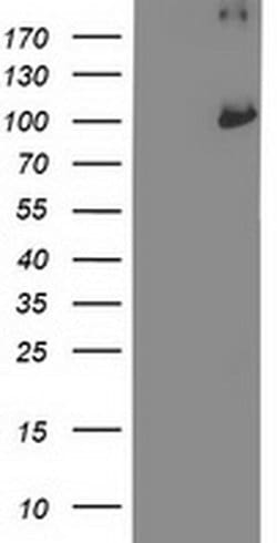 PSMD2 Monoclonal Antibody (OTI1H3), TrueMAB , OriGene 30 &mu;L | Buy Online | OriGene | Fisher Scientific