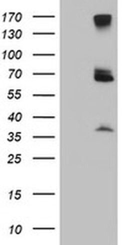 PSMD3 Monoclonal Antibody (OTI2A2), TrueMAB , OriGene 100 &mu;L; Unconjugated:Antibodies,