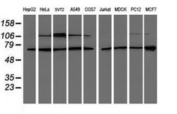 PSMD3 Monoclonal Antibody (OTI2A2), TrueMAB , OriGene 100 &mu;L; Unconjugated:Antibodies,