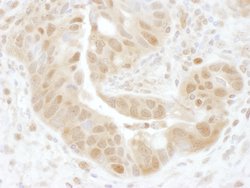 PSMD7 Rabbit anti-Human, Mouse, Polyclonal, Bethyl Laboratories 100 &mu;L;