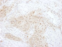 PSMD7 Rabbit anti-Human, Mouse, Polyclonal, Bethyl Laboratories 100 &mu;L;