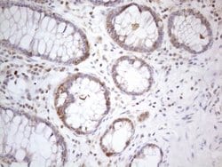 PSMG2 Monoclonal Antibody (OTI1E8), TrueMAB , OriGene 100 &mu;L; Unconjugated:Antibodies,