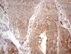 PSMG2 Monoclonal Antibody (OTI2E12), TrueMAB , OriGene 100 &mu;L; Unconjugated:Antibodies,