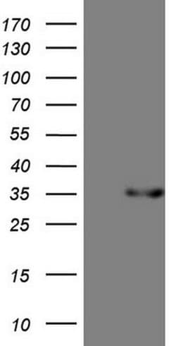PSMG2 Monoclonal Antibody (OTI2E12), TrueMAB , OriGene:Antibodies:Primary
