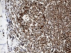 PTBP3 Monoclonal Antibody (OTI5C9), TrueMAB , OriGene:Antibodies:Primary