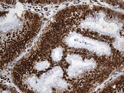 PTBP3 Monoclonal Antibody (OTI5C9), TrueMAB , OriGene 100 &mu;L; Unconjugated:Antibodies,