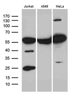 PTBP3 Mouse anti-Human, Clone: OTI5G7, TrueMAB , Origene 30 &mu;L; Unconjugated:Antibodies,