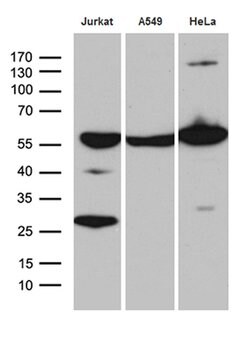 PTBP3 Monoclonal Antibody (OTI5C9), TrueMAB , OriGene:Antibodies:Primary