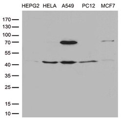 PTCD3 Monoclonal Antibody (OTI1A8), TrueMAB , OriGene 30 &mu;L; Unconjugated:Antibodies,