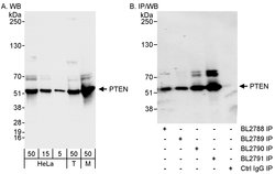 PTEN Rabbit anti-Human, Mouse, Polyclonal, Bethyl Laboratories 100 &mu;L;