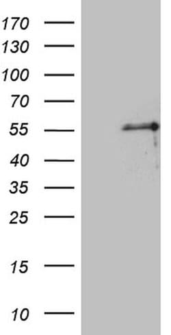PTF1A Mouse anti-Human, Mouse, Rat, Clone: OTI1H6, lyophilized, TrueMAB