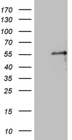 PTF1A Monoclonal Antibody (OTI1H6), TrueMAB , OriGene 30 &mu;L; Unconjugated:Antibodies,
