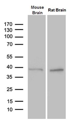 PTF1A Monoclonal Antibody (OTI1H6), TrueMAB , OriGene 30 &mu;L; Unconjugated:Antibodies,