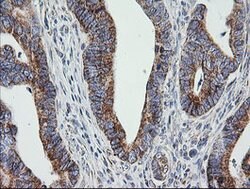 PTGES2 Mouse anti-Human, Clone: OTI2C3, lyophilized, TrueMAB 100 &mu;g;