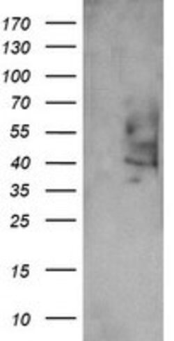 PTGES2 Mouse anti-Human, Clone: OTI2C3, lyophilized, TrueMAB 100 &mu;g;