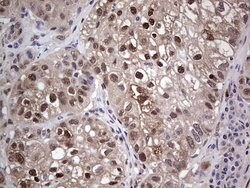 PTGS2 Mouse anti-Human, Clone: OTI10H5, lyophilized, TrueMAB 100 &mu;g;
