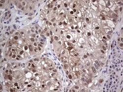 PTGS2 Monoclonal Antibody (OTI10H5), TrueMAB , OriGene:Antibodies:Primary