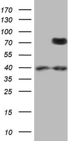 PTGS2 Monoclonal Antibody (OTI4C4), TrueMAB , OriGene:Antibodies:Primary