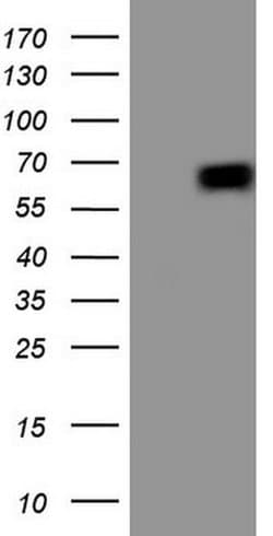 PTGS2 Monoclonal Antibody (OTI2E1), TrueMAB , OriGene 100 &mu;L; Unconjugated:Antibodies,