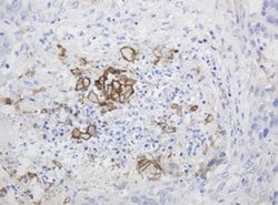 PTH Monoclonal Antibody (OTI1C6), TrueMAB , OriGene:Antibodies:Primary