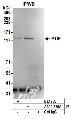PTIP Rabbit anti-Human, Polyclonal, Bethyl Laboratories 100 &mu;L; Unconjugated:Antibodies,
