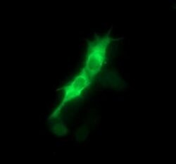 PTK2 Mouse anti-Human, Clone: OTI4A8, lyophilized, TrueMAB 100 &mu;g; Unconjugated:Antibodies,