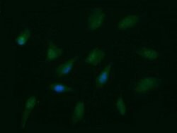 PTK2 Mouse anti-Human, Clone: OTI4A8, lyophilized, TrueMAB 100 &mu;g; Unconjugated:Antibodies,