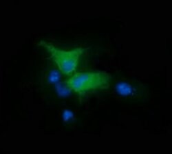 PTK2 Monoclonal Antibody (OTI4D11), TrueMAB , OriGene 100 &mu;L; Unconjugated:Antibodies,