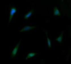 PTK2 Monoclonal Antibody (OTI4D11), TrueMAB , OriGene 100 &mu;L; Unconjugated:Antibodies,