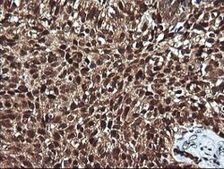 PTK2 Mouse anti-Human, Clone: OTI4A8, lyophilized, TrueMAB 100 &mu;g; Unconjugated:Antibodies,