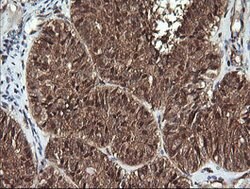 PTK2 Mouse anti-Human, Clone: OTI4A8, lyophilized, TrueMAB 100 &mu;g; Unconjugated:Antibodies,