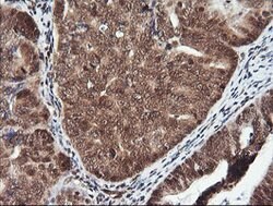 PTK2 Mouse anti-Human, Clone: OTI4A8, lyophilized, TrueMAB 100 &mu;g; Unconjugated:Antibodies,