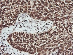 PTK2 Monoclonal Antibody (OTI4D11), TrueMAB , OriGene 100 &mu;L; Unconjugated:Antibodies,