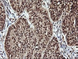 PTK2 Monoclonal Antibody (OTI4D11), TrueMAB , OriGene 100 &mu;L; Unconjugated:Antibodies,