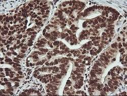PTK2 Monoclonal Antibody (OTI4D11), TrueMAB , OriGene 100 &mu;L; Unconjugated:Antibodies,