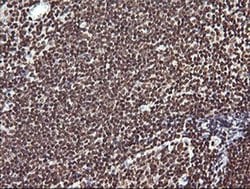 PTK2 Monoclonal Antibody (OTI4D11), TrueMAB , OriGene 100 &mu;L; Unconjugated:Antibodies,