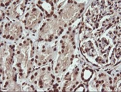 PTK2 Monoclonal Antibody (OTI4D11), TrueMAB , OriGene 100 &mu;L; Unconjugated:Antibodies,