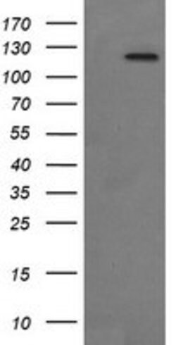 PTK2 Mouse anti-Human, Clone: OTI4A8, lyophilized, TrueMAB 100 &mu;g; Unconjugated:Antibodies,