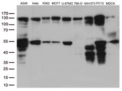 PTK2 Mouse anti-Human, Clone: OTI4A8, lyophilized, TrueMAB 100 &mu;g; Unconjugated:Antibodies,
