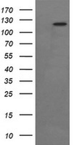 PTK2 Monoclonal Antibody (OTI4D11), TrueMAB , OriGene 100 &mu;L; Unconjugated:Antibodies,
