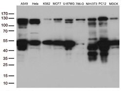 PTK2 Monoclonal Antibody (OTI4D11), TrueMAB , OriGene 100 &mu;L; Unconjugated:Antibodies,