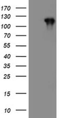PTK7 Monoclonal Antibody (OTI1G4), TrueMAB , OriGene 100 &mu;L; Unconjugated:Antibodies,