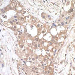 PTPIP51 Rabbit anti-Human, Polyclonal, Bethyl Laboratories 100 &mu;L; Unconjugated:Antibodies,