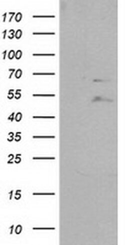 PTPN11 Monoclonal Antibody (OTI3F2), TrueMAB , OriGene 30 &mu;L; Unconjugated:Antibodies,