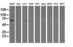 PTPN11 Monoclonal Antibody (OTI3F2), TrueMAB , OriGene 30 &mu;L; Unconjugated:Antibodies,