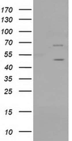 PTPN11 Monoclonal Antibody (OTI2F4), TrueMAB , OriGene 100 &mu;L; Unconjugated:Antibodies,
