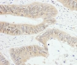PTPN12 Rabbit anti-Human, Polyclonal, Bethyl Laboratories 100 &mu;L; Unconjugated:Antibodies,