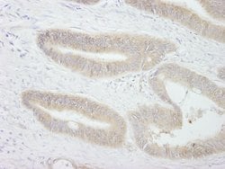 PTPN12 Polyclonal Antibody, Bethyl Laboratories 100 &mu;L; Unconjugated:Antibodies,