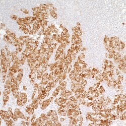 PTPN12 Recombinant Rabbit Monoclonal Antibody (BL-5-2F8), Bethyl Laboratories